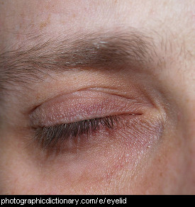 Photo of an eyelid