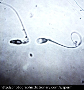 Sperm cells