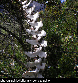 Photo of a spine