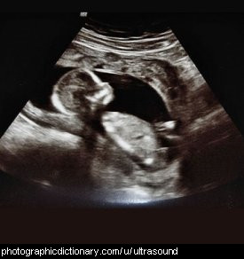 An ultrasound image